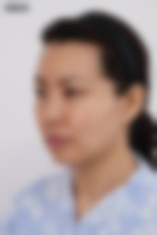 临床实例分享