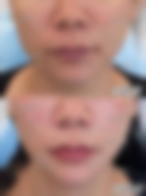 预约优惠活动