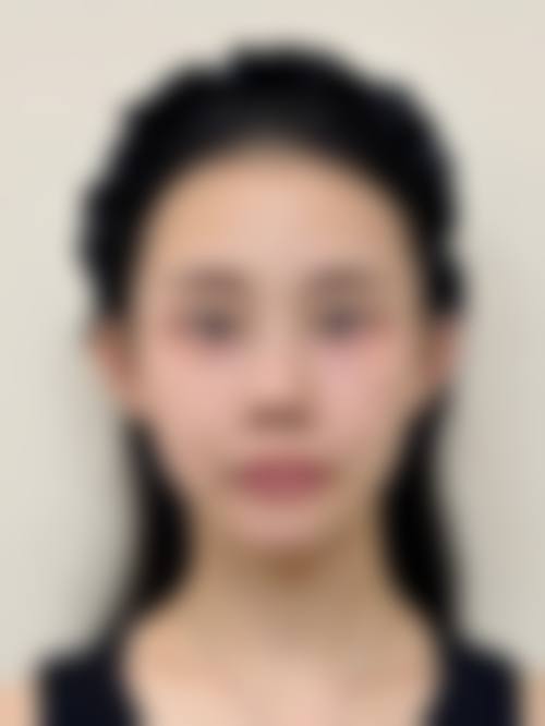 擅长项目详解