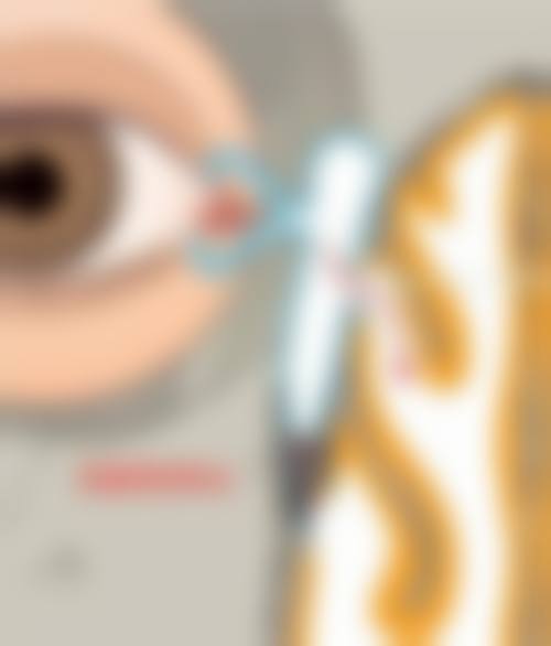 预约优惠活动