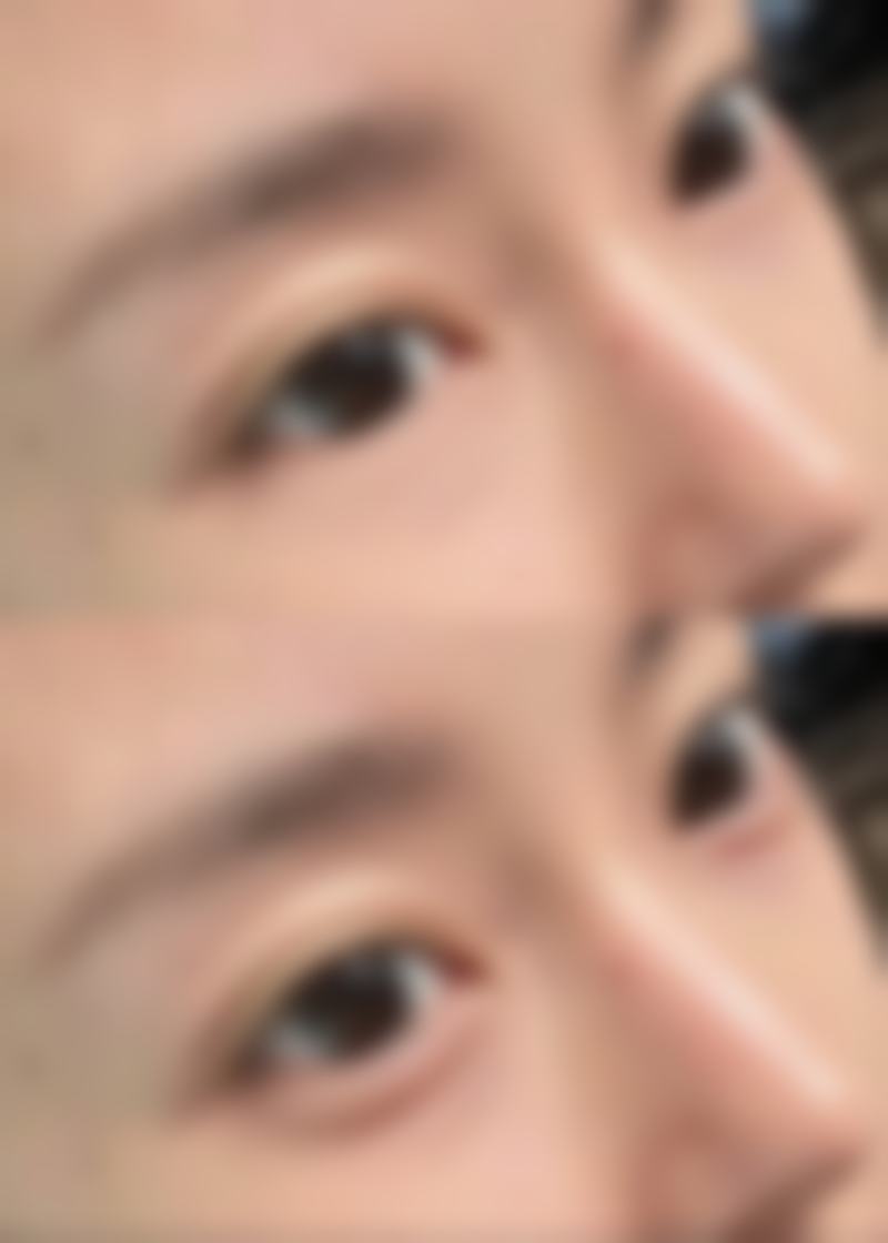 东莞格美雅韵整形医院特色项目有哪些?