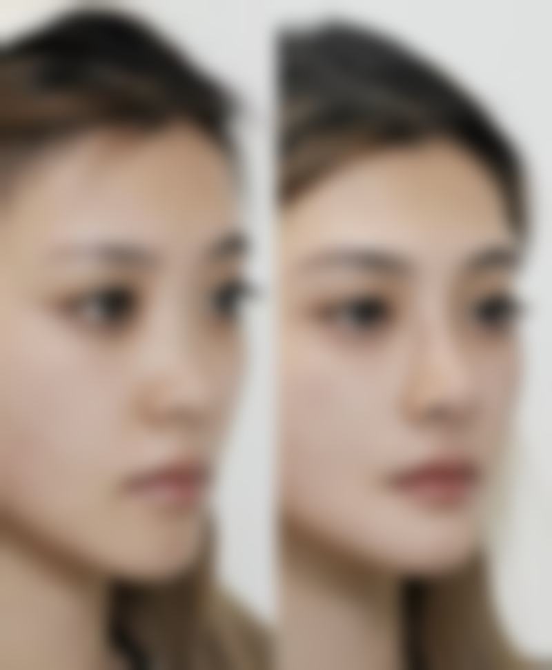 银川新面孔整形医院是正规的吗?
