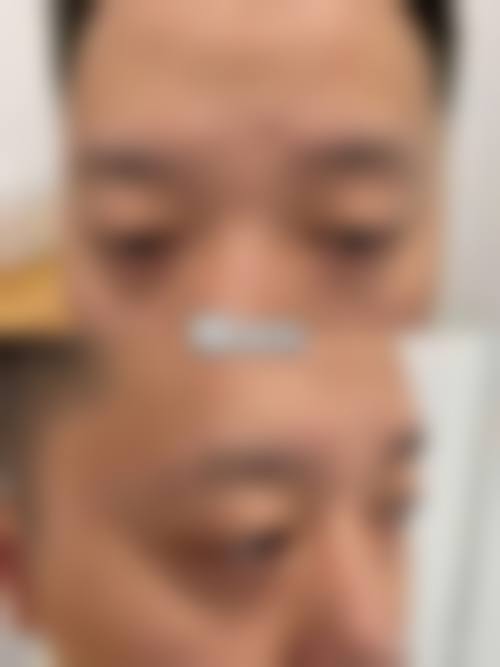 临床实例分享:李高飞医生的真实反馈