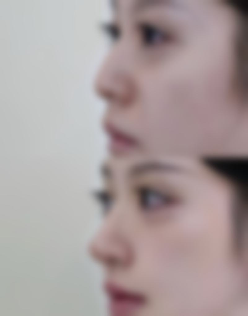 北海市中医医院皮肤美容科是正规的吗?