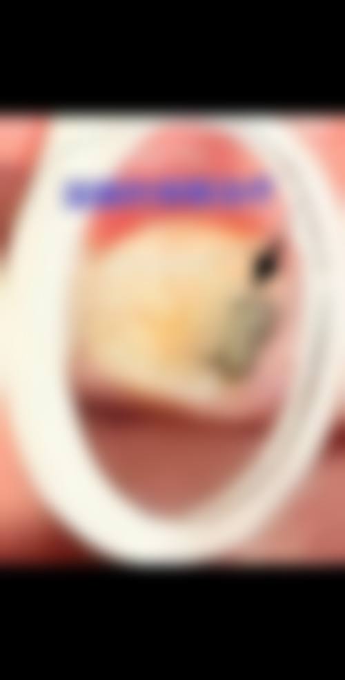 患者真实评价