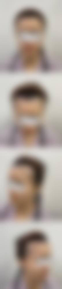 擅长项目详解深圳回来医疗美容门诊部高卿豪
