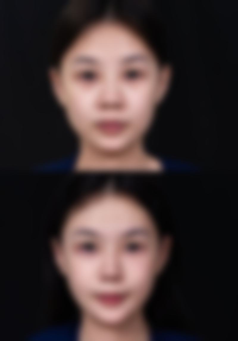 北京青蓝医疗美容诊所是正规的吗?
